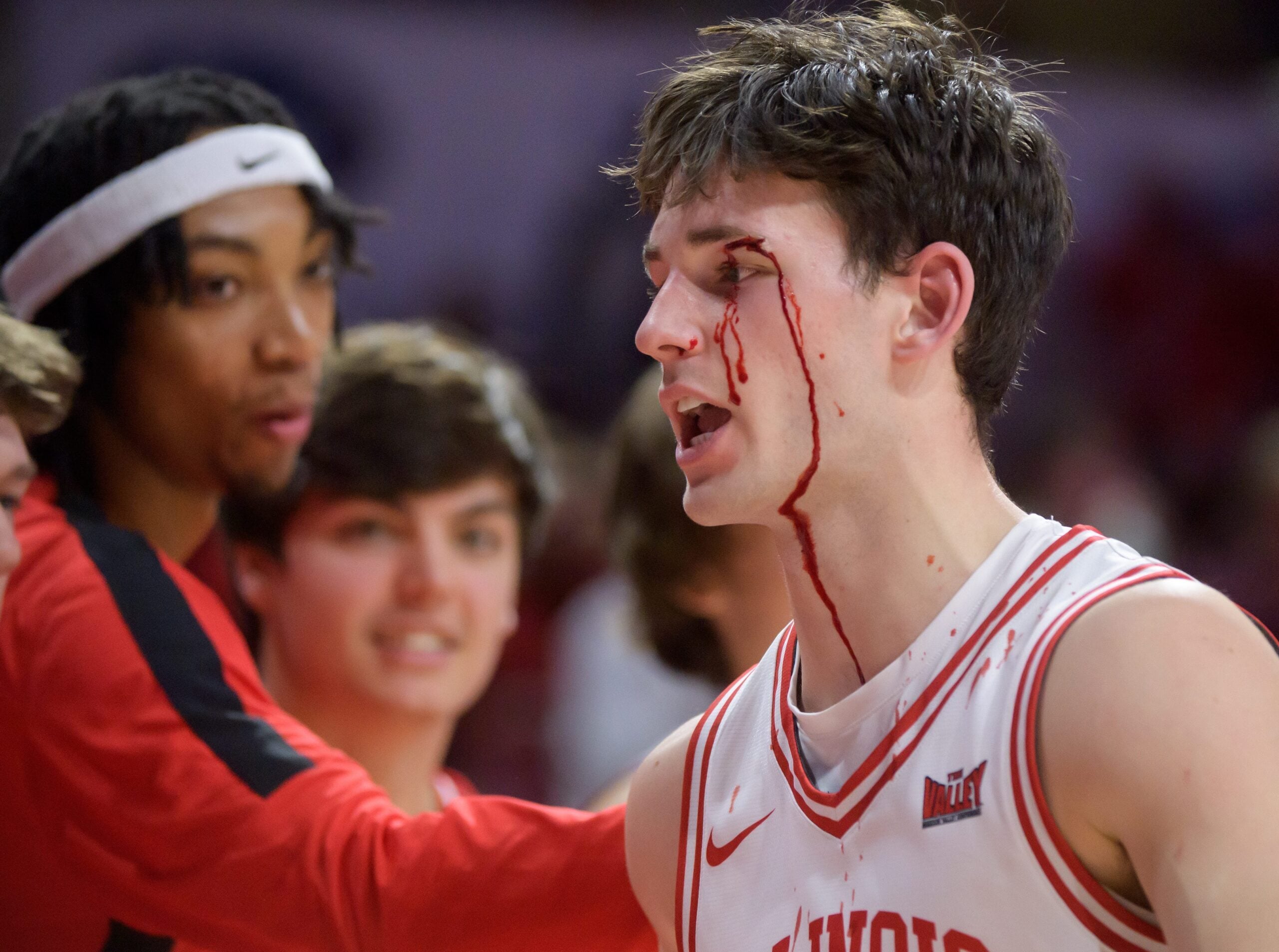 A stream of blood flows down Illinois State guard Johnny Kinziger’s face after a collision with Bradley’s Zek Montgomery in the first half of their Missouri Valley Conference basketball game Wednesday, Feb. 19, 2025 at CEFCU in Normal. The Braves fell to the Redbirds 82-71.