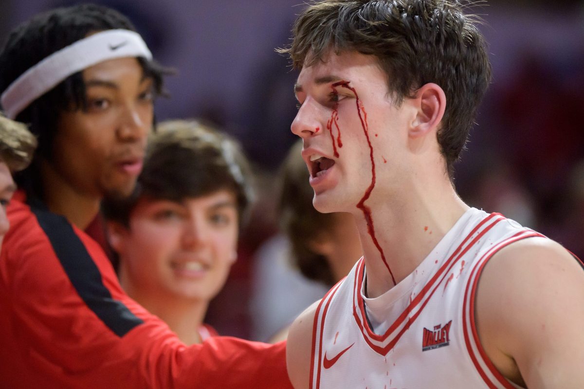 A stream of blood flows down Illinois State guard Johnny Kinziger’s face after a collision with Bradley’s Zek Montgomery in the first half of their Missouri Valley Conference basketball game Wednesday, Feb. 19, 2025 at CEFCU in Normal. The Braves fell to the Redbirds 82-71.