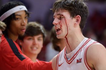 A stream of blood flows down Illinois State guard Johnny Kinziger’s face after a collision with Bradley’s Zek Montgomery in the first half of their Missouri Valley Conference basketball game Wednesday, Feb. 19, 2025 at CEFCU in Normal. The Braves fell to the Redbirds 82-71.