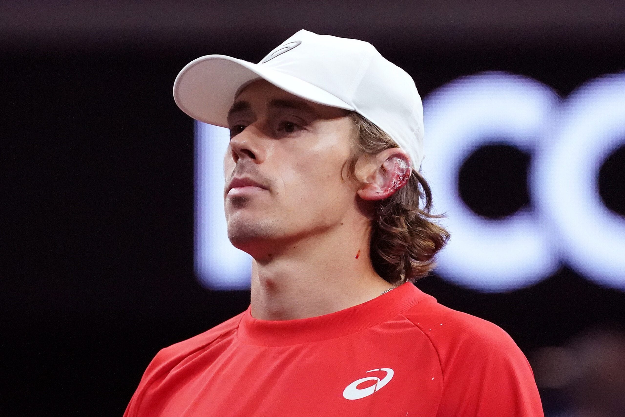 Sep 20, 2025; San Francisco, CA, USA; Team World Player Alex de Minaur injures his ear after hitting it with his racket during a doubles match against Team Europe players Holger Rune and Casper Ruud at the Laver Cup at Chase Center. Mandatory Credit: David Gonzales-Imagn Images